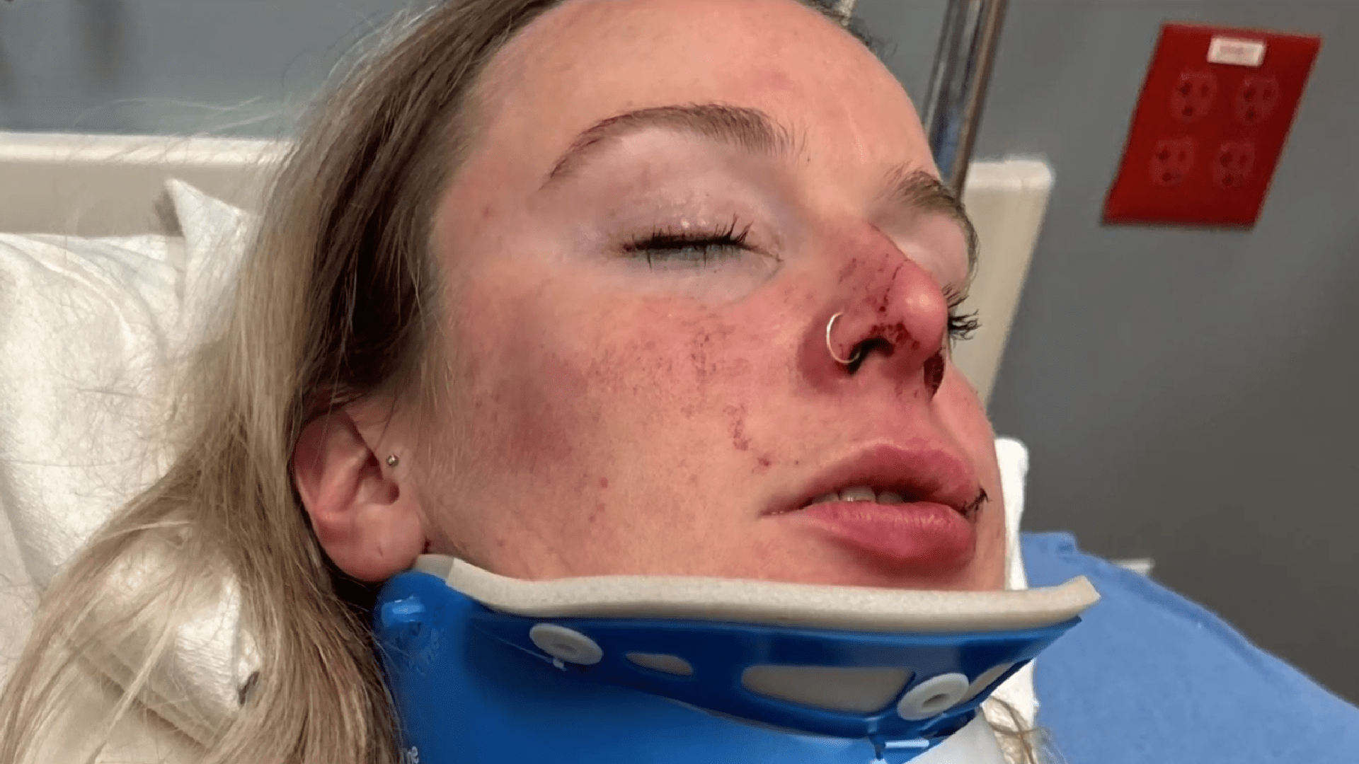 MGM Detroit Security ‘Did Nothing’ as LGBTQ+ Woman Beaten in Alleged Hate Crime